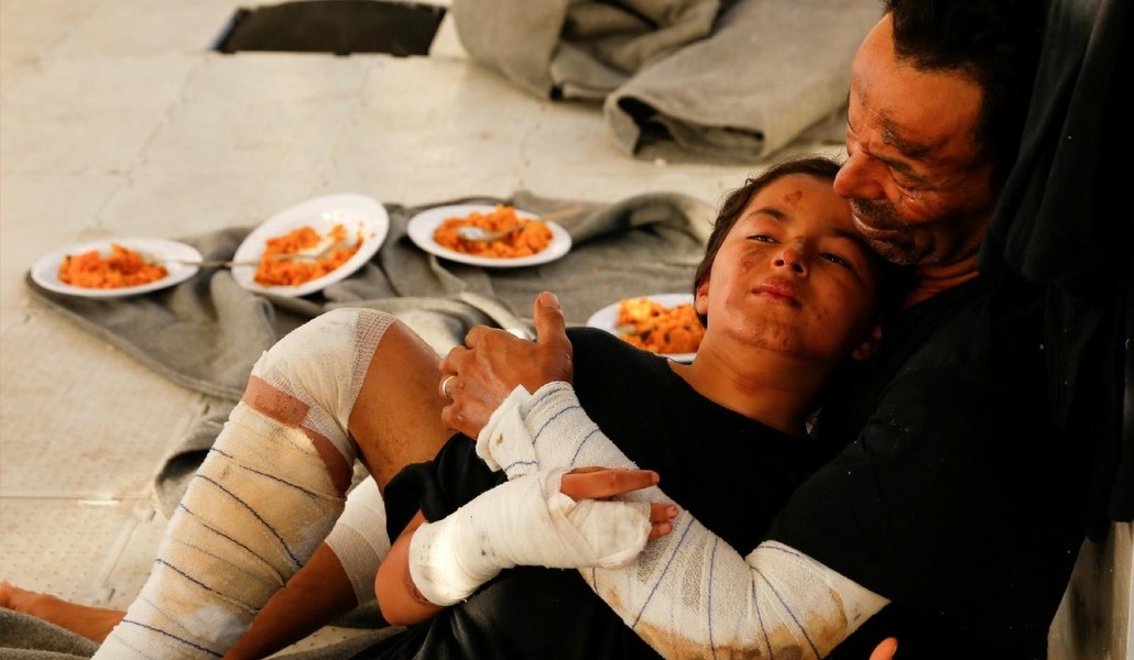 Un hombre libio y su hija con quemaduras se recuperan tras haber sido rescatados por una ONG de rescate en el Mediterráneo