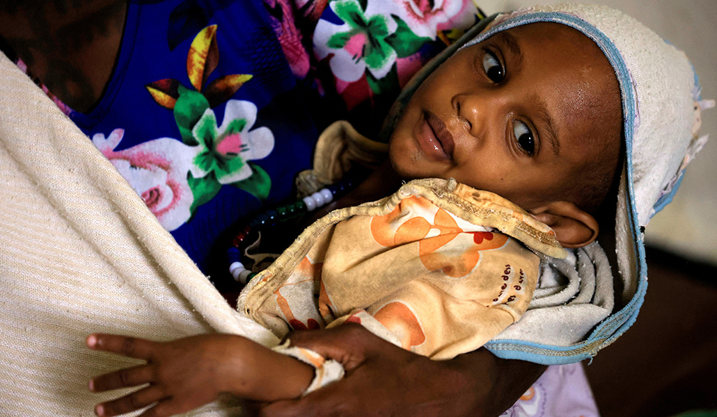 Una madre carga a su hija desnutrida en Tigray, una región de Etiopía azotada por el hambre.